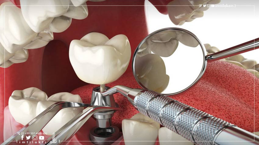 Qu Est Ce Qu Une Infrastructure Coronaire Sur Implant