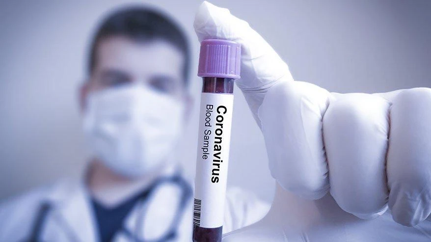laboratoire test covid istanbul
