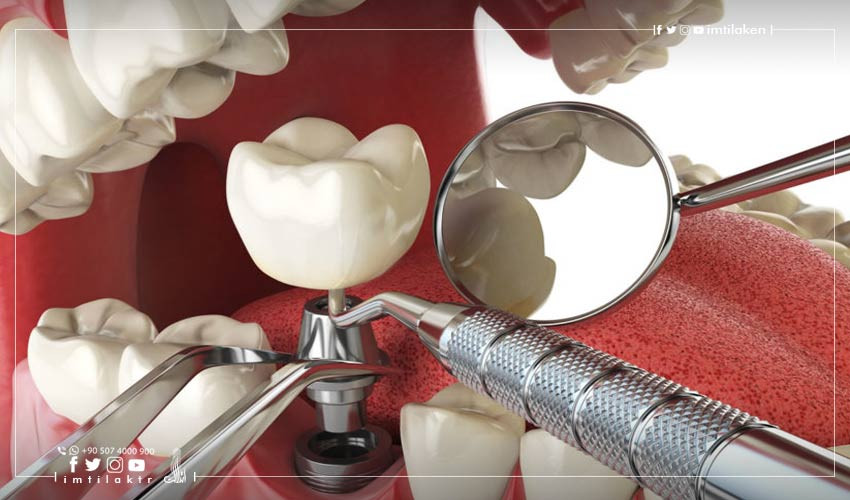 Implant dentaire en Turquie: demande croissante et prix favorables